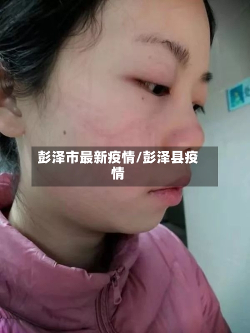 彭泽市最新疫情/彭泽县疫情-第2张图片