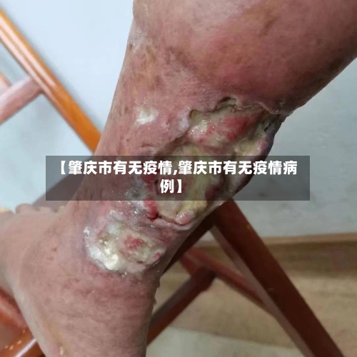 【肇庆市有无疫情,肇庆市有无疫情病例】-第2张图片